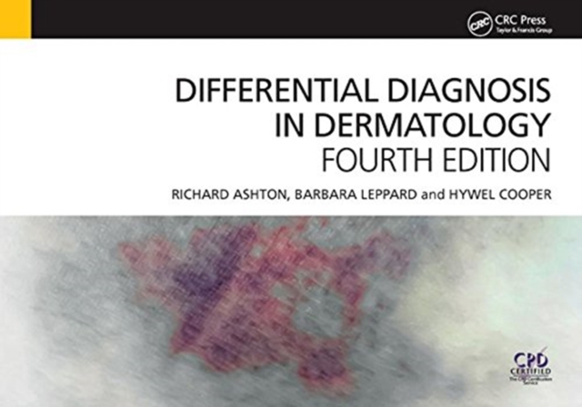 Differential Diagnosis in Dermatology, Hardback Book