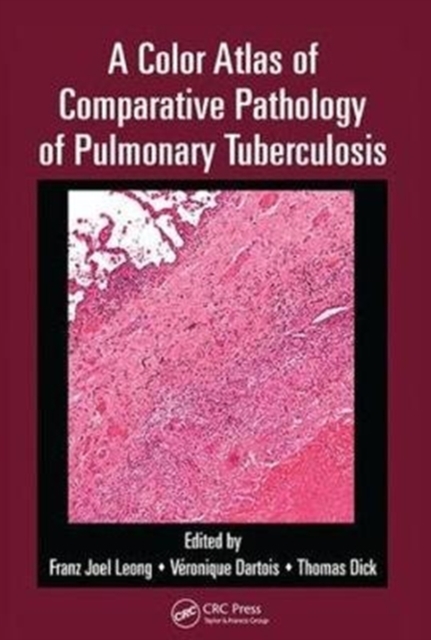 A Color Atlas of Comparative Pathology of Pulmonary Tuberculosis, Hardback Book
