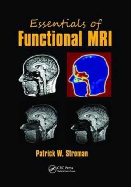 Essentials of Functional MRI, Hardback Book