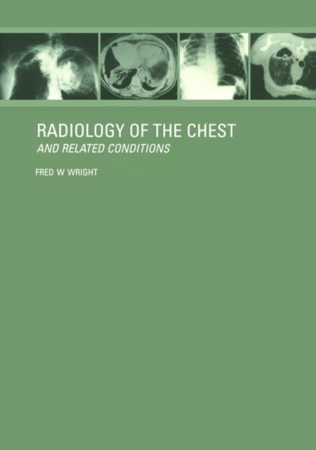 Radiology of the Chest and Related Conditions, Hardback Book