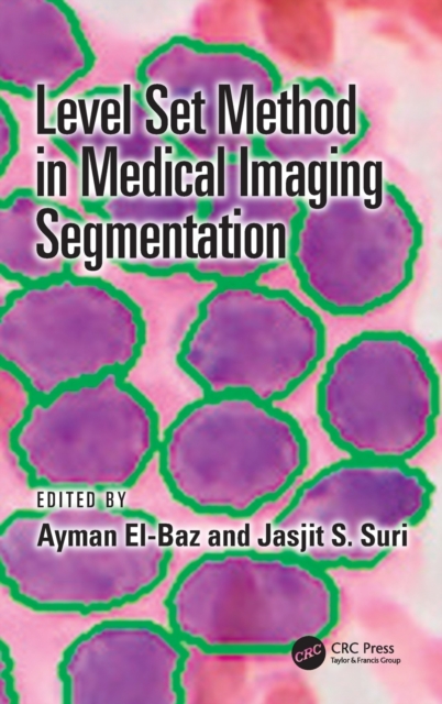 Level Set Method in Medical Imaging Segmentation, Hardback Book