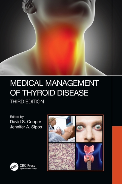 Medical Management of Thyroid Disease, Third Edition, Hardback Book