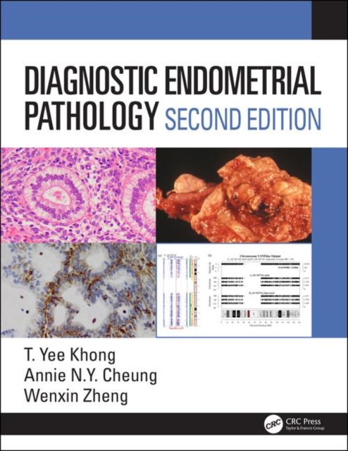 Diagnostic Endometrial Pathology 2E, Hardback Book