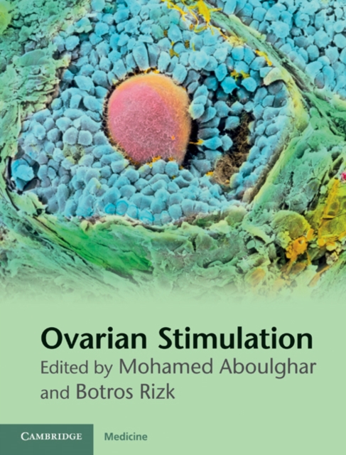 Ovarian Stimulation, EPUB eBook