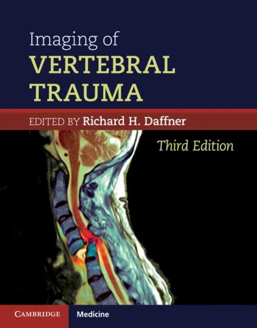 Imaging of Vertebral Trauma, EPUB eBook