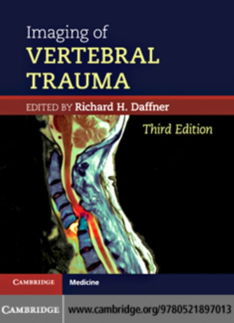 Imaging of Vertebral Trauma, PDF eBook