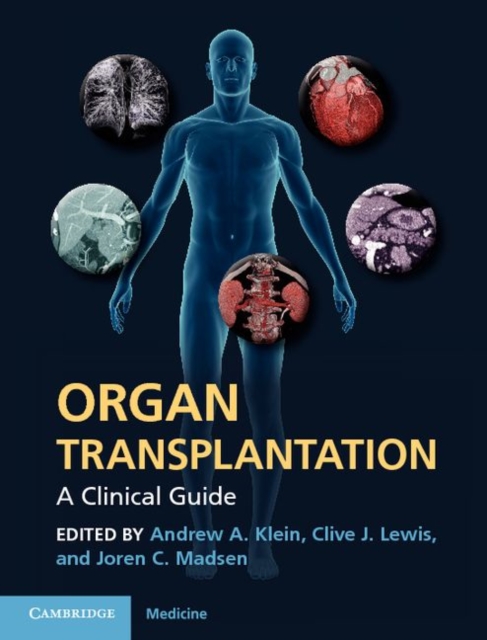 Organ Transplantation : A Clinical Guide, PDF eBook