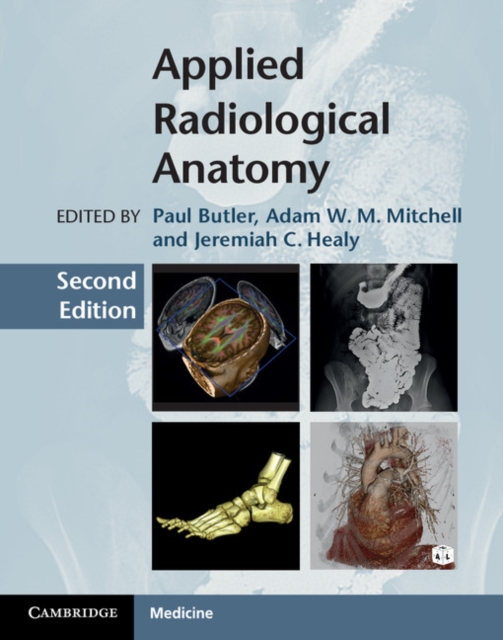 Applied Radiological Anatomy, PDF eBook