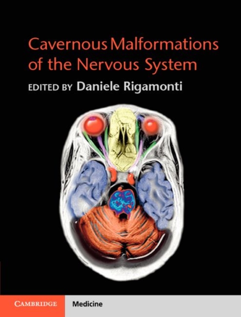 Cavernous Malformations of the Nervous System, PDF eBook