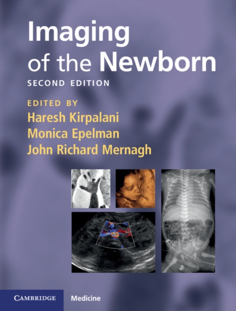 Imaging of the Newborn, EPUB eBook
