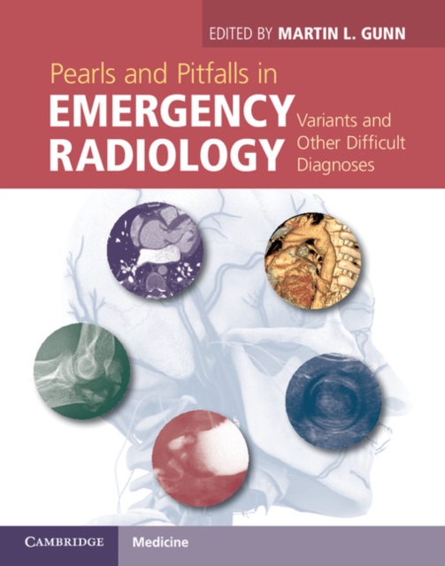 Pearls and Pitfalls in Emergency Radiology : Variants and Other Difficult Diagnoses, PDF eBook