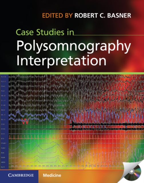 Case Studies in Polysomnography Interpretation, PDF eBook