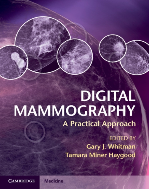 Digital Mammography : A Practical Approach, PDF eBook