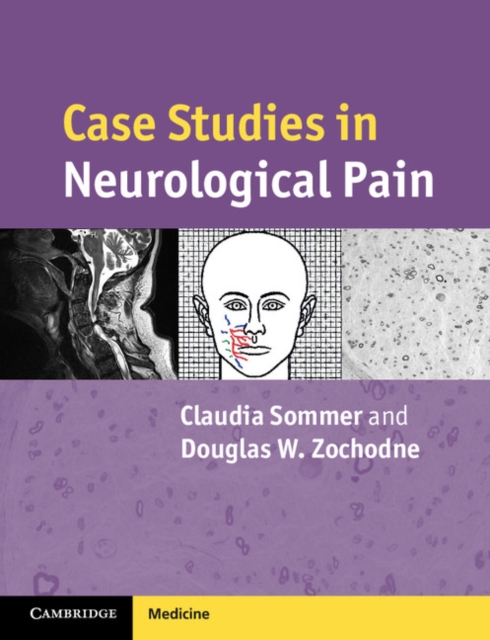 Case Studies in Neurological Pain, EPUB eBook