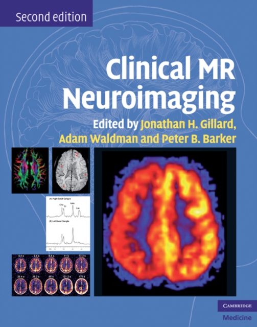 Clinical MR Neuroimaging : Physiological and Functional Techniques, PDF eBook