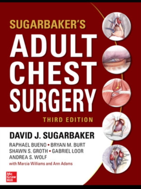 Sugarbaker's Adult Chest Surgery, Hardback Book
