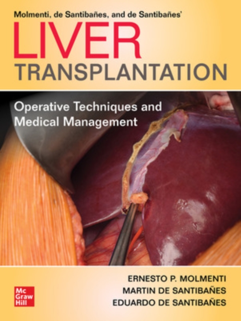 Liver Transplantation: Operative Techniques and Medical Management, Paperback / softback Book
