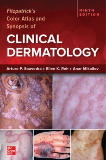 Fitzpatrick's Color Atlas and Synopsis of Clinical Dermatology, Ninth Edition, Paperback / softback Book