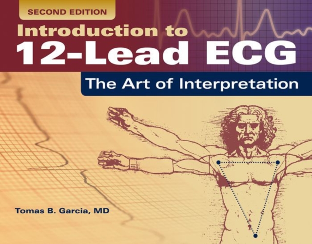Introduction To 12-Lead ECG: The Art Of Interpretation, Paperback / softback Book
