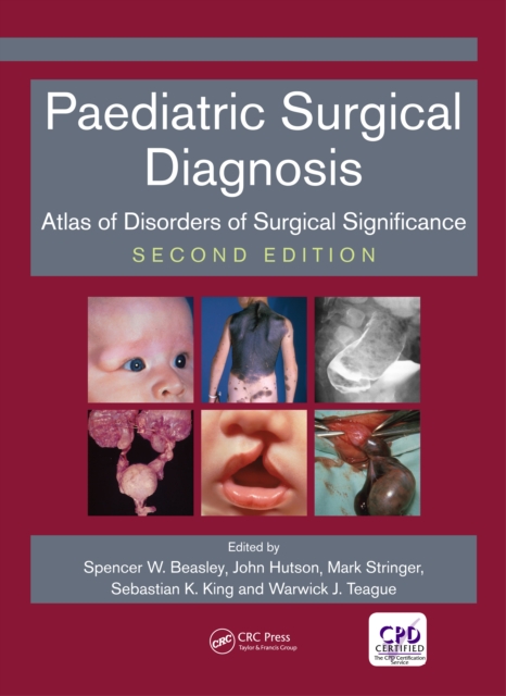 Paediatric Surgical Diagnosis : Atlas of Disorders of Surgical Significance, Second Edition, EPUB eBook