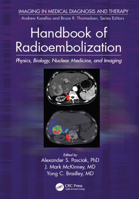 Handbook of Radioembolization : Physics, Biology, Nuclear Medicine, and Imaging, EPUB eBook