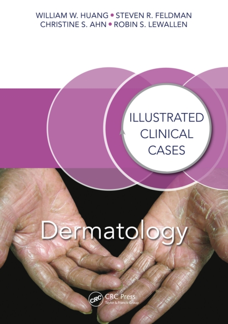Dermatology : Illustrated Clinical Cases, EPUB eBook