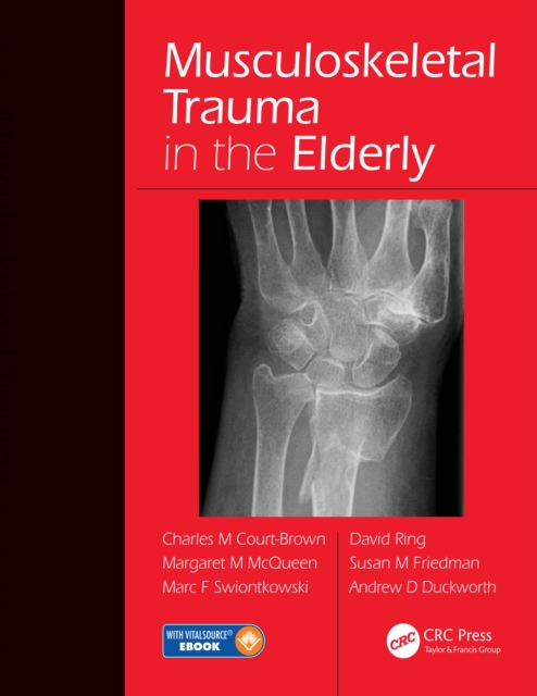 Musculoskeletal Trauma in the Elderly, PDF eBook