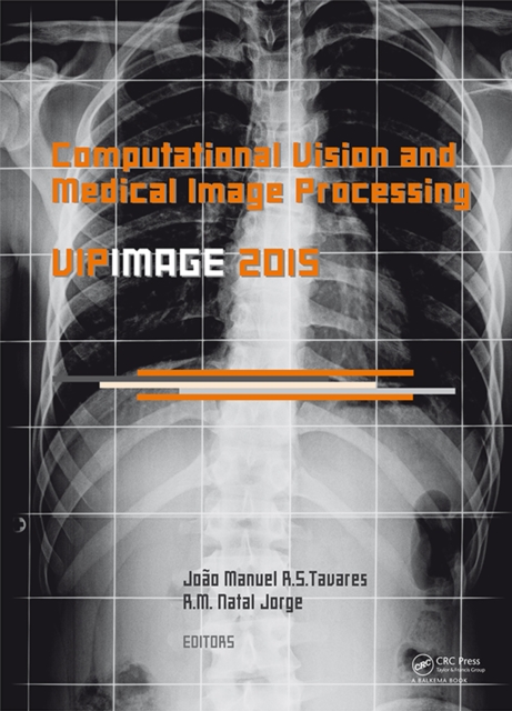 Computational Vision and Medical Image Processing V : Proceedings of the 5th Eccomas Thematic Conference on Computational Vision and Medical Image Processing (VipIMAGE 2015, Tenerife, Spain, October 1, PDF eBook