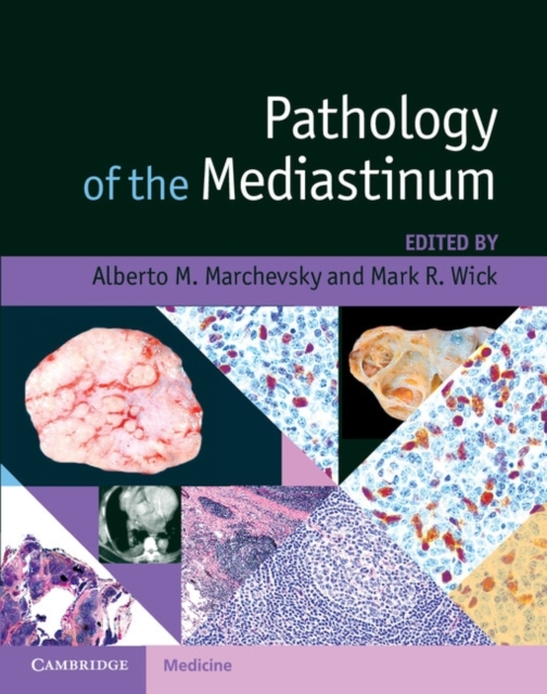 Pathology of the Mediastinum, PDF eBook