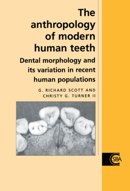 Anthropology of Modern Human Teeth : Dental Morphology and its Variation in Recent Human Populations, PDF eBook