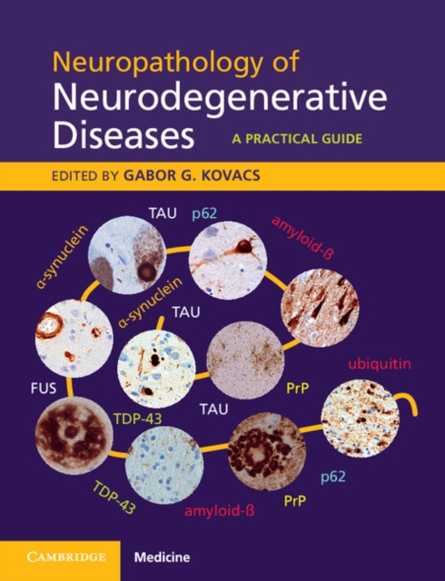 Neuropathology of Neurodegenerative Diseases : A Practical Guide, EPUB eBook