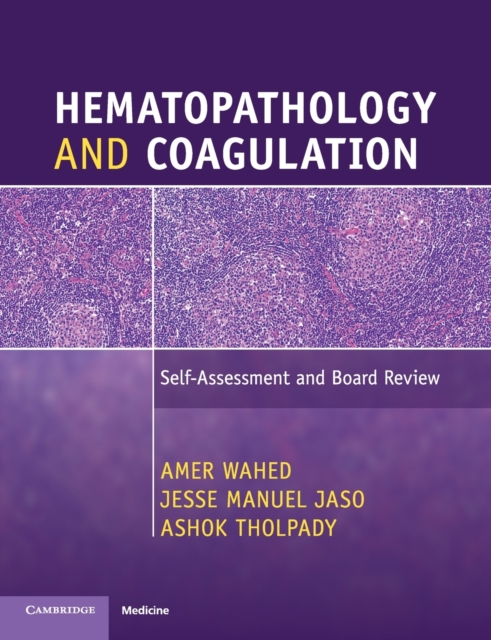 Hematopathology and Coagulation : Self-Assessment and Board Review, Paperback / softback Book