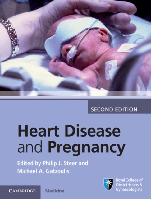 Heart Disease and Pregnancy, PDF eBook