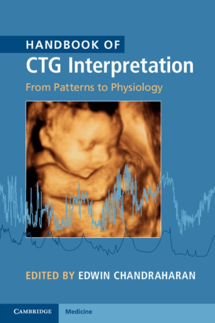 Handbook of CTG Interpretation : From Patterns to Physiology, PDF eBook