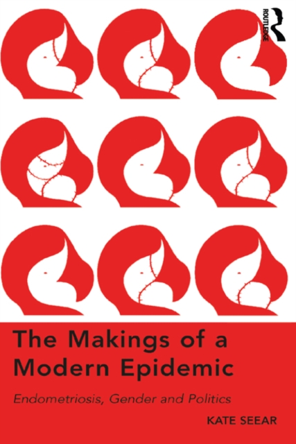The Makings of a Modern Epidemic : Endometriosis, Gender and Politics, EPUB eBook