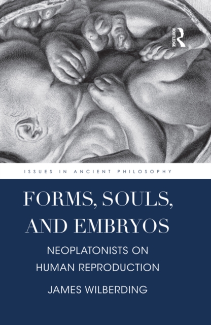 Forms, Souls, and Embryos : Neoplatonists on Human Reproduction, EPUB eBook