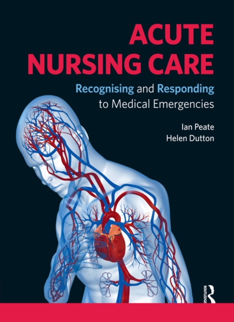 Acute Nursing Care : Recognising and Responding to Medical Emergencies, EPUB eBook