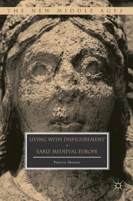 Living with Disfigurement in Early Medieval Europe, Hardback Book