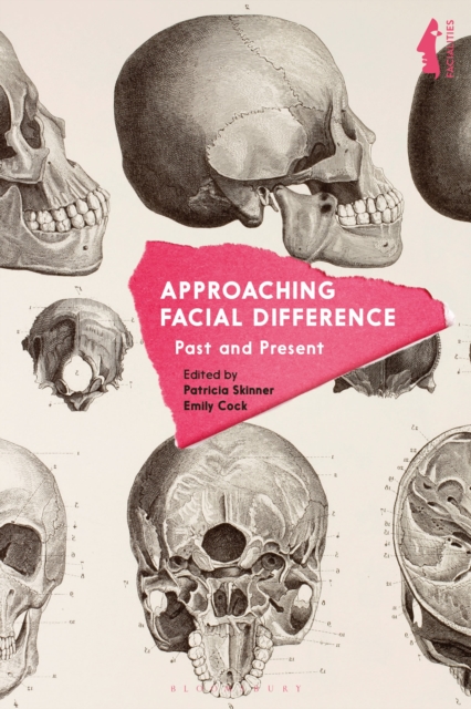 Approaching Facial Difference : Past and Present, Hardback Book