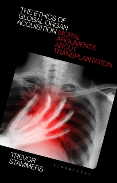 The Ethics of Global Organ Acquisition : Moral Arguments about Transplantation, PDF eBook