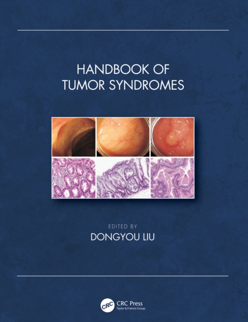 Handbook of Tumor Syndromes, EPUB eBook