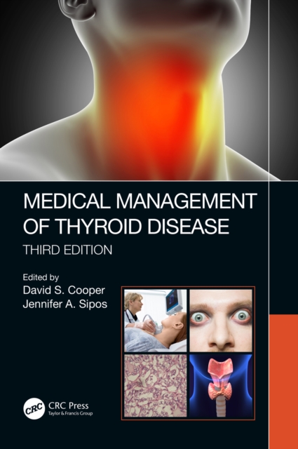 Medical Management of Thyroid Disease, Third Edition, EPUB eBook