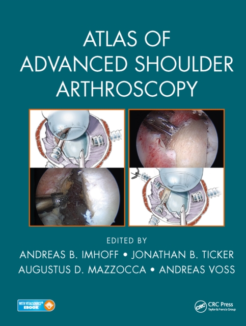 Atlas of Advanced Shoulder Arthroscopy, EPUB eBook