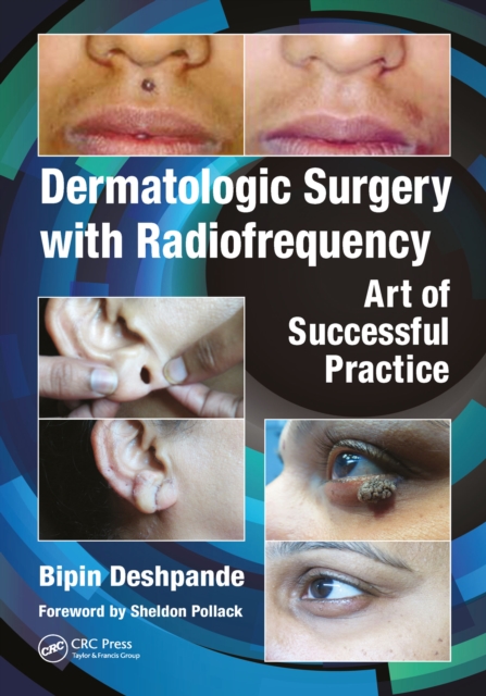 Dermatologic Surgery with Radiofrequency : Art of Successful Practice, EPUB eBook