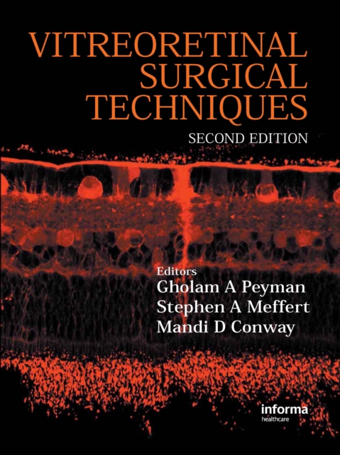 Vitreoretinal Surgical Techniques, Second Edition, EPUB eBook