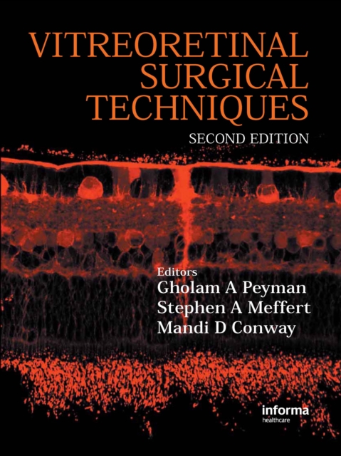 Vitreoretinal Surgical Techniques, Second Edition, PDF eBook