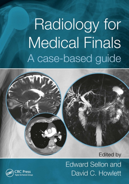 Radiology for Medical Finals : A case-based guide, EPUB eBook