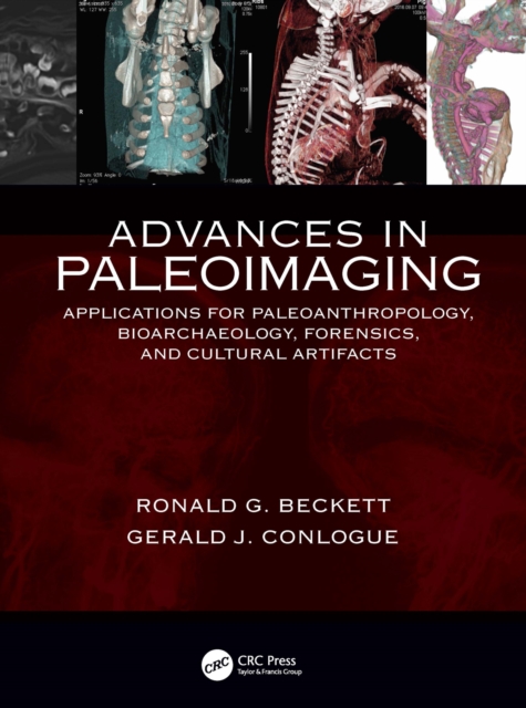 Advances in Paleoimaging : Applications for Paleoanthropology, Bioarchaeology, Forensics, and Cultural Artifacts, PDF eBook
