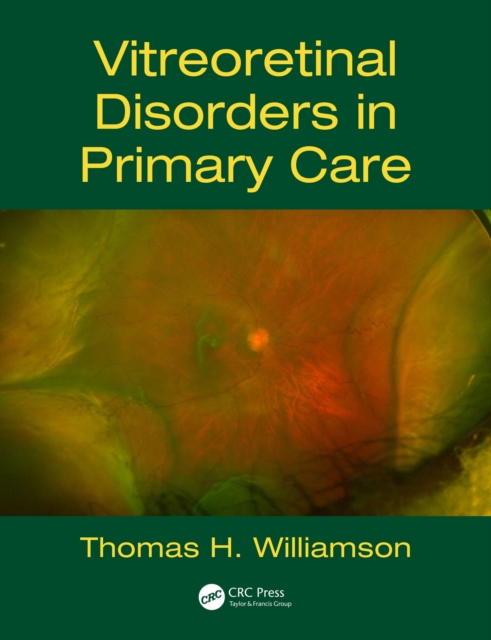 Vitreoretinal Disorders in Primary Care, EPUB eBook