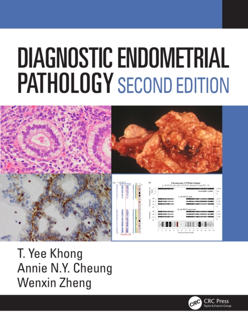 Diagnostic Endometrial Pathology 2E, EPUB eBook